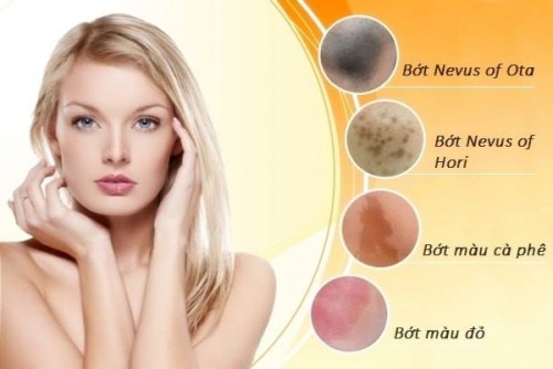 ĐIỀU TRỊ CHÀM - BỚT BẨM SINH