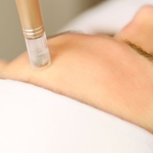 MESO KHÔNG KIM CHĂM SÓC DA