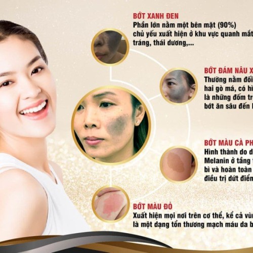 CA CHÀM BỚT THỰC TẾ