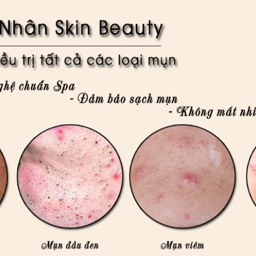 Dịch vụ điều trị mụn