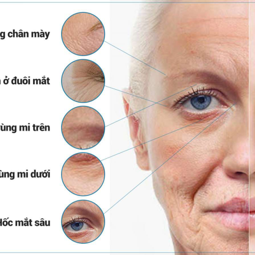 HỒNG NHÂN (XÓA NHĂN)