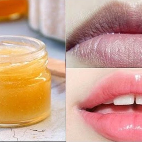 Công nghệ khử thâm môi nhẹ nhàng