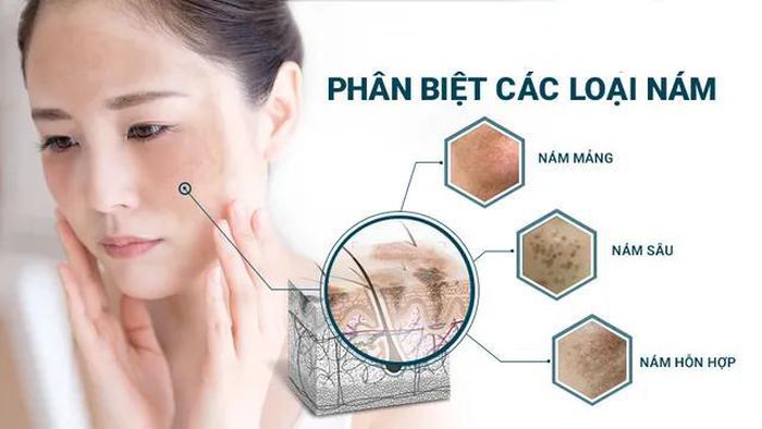 pha biet nam 3
