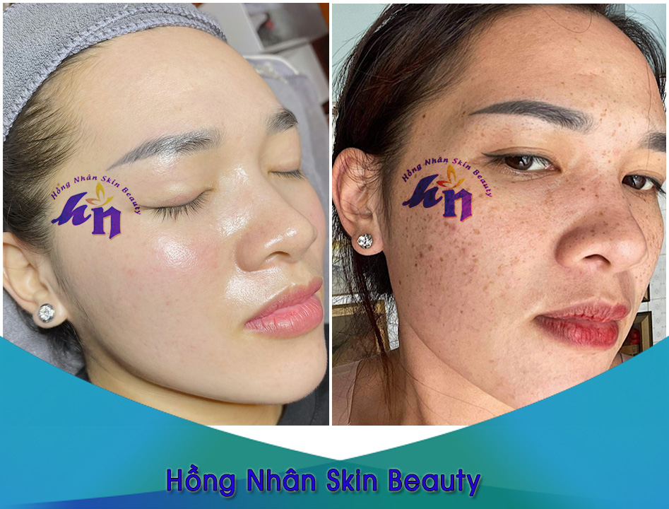 tan nhang 250222
