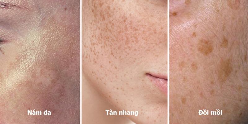 CÁC LIỆU TRÌNH NÁM - TÀN NHANG - ĐỒI MỒI
