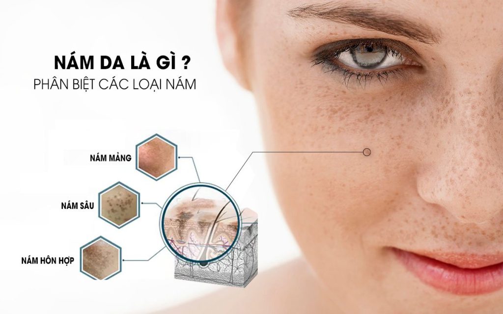 cach chua nam va tim hieu nam da la gi 1024x640