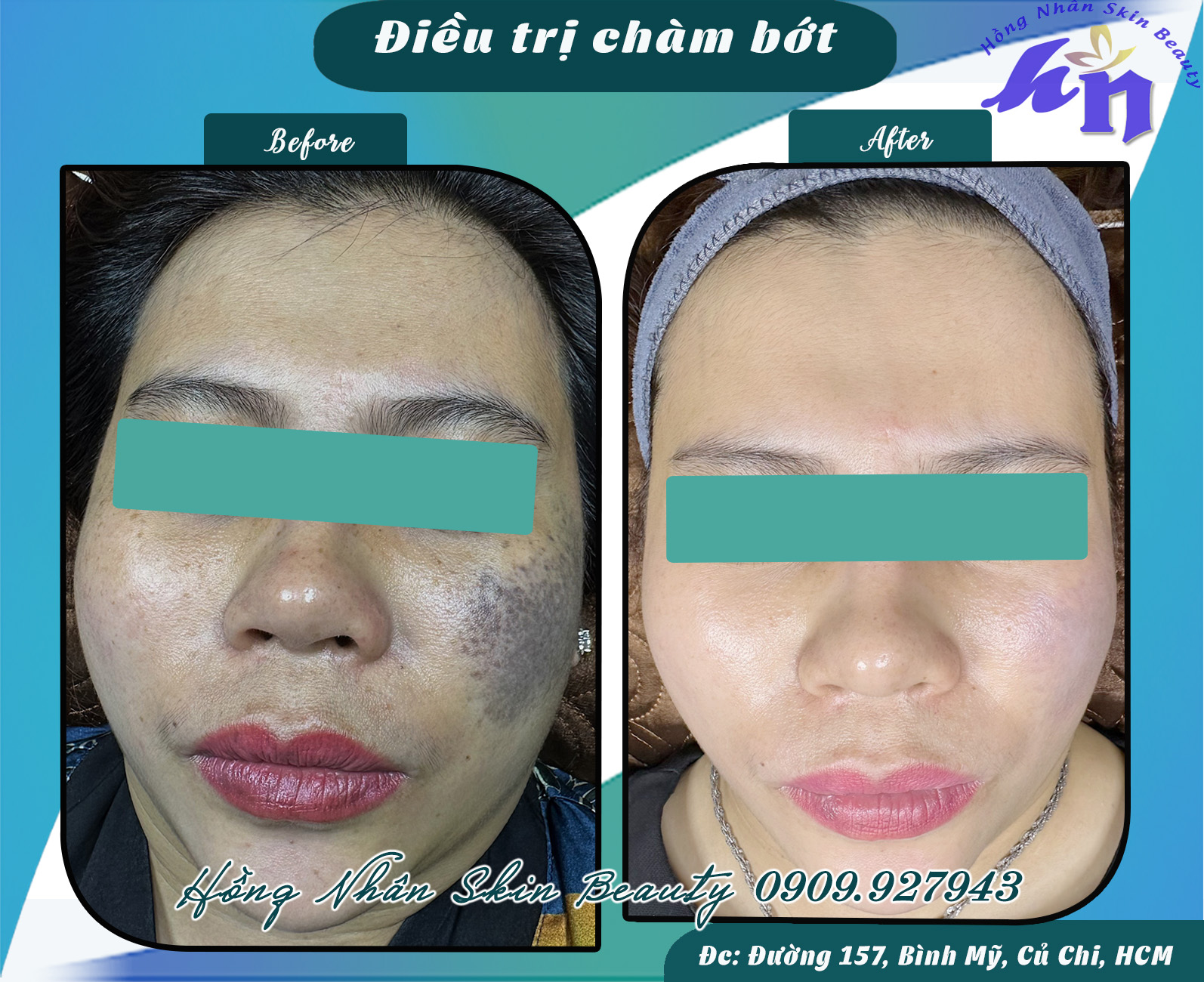 dang cham bot 030424 hns cd