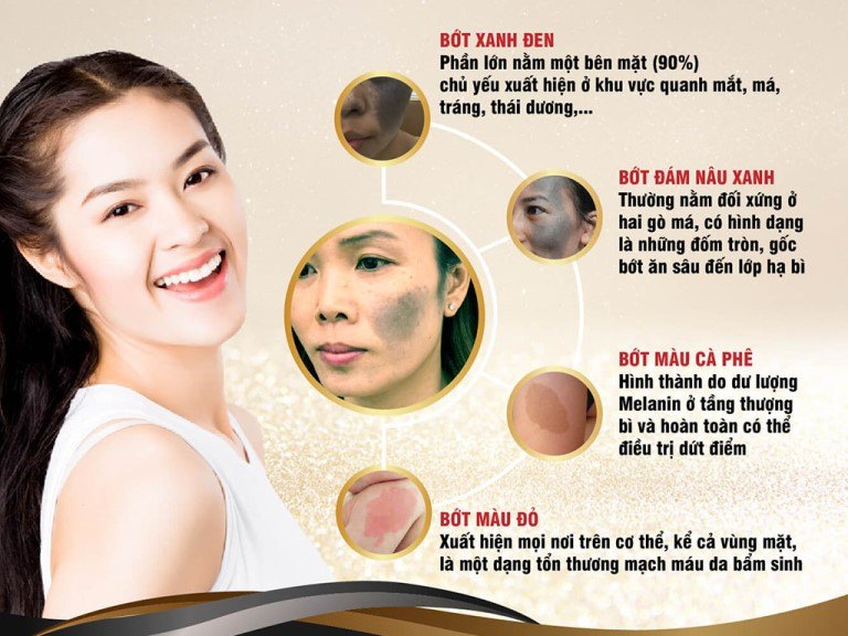 CA CHÀM BỚT THỰC TẾ