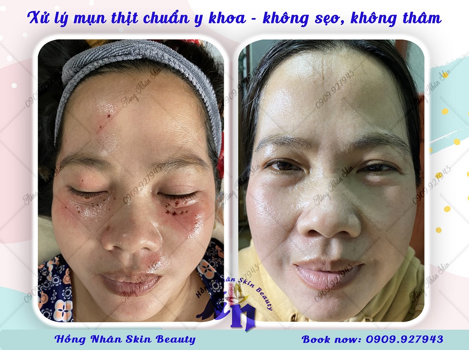mun thit hns web