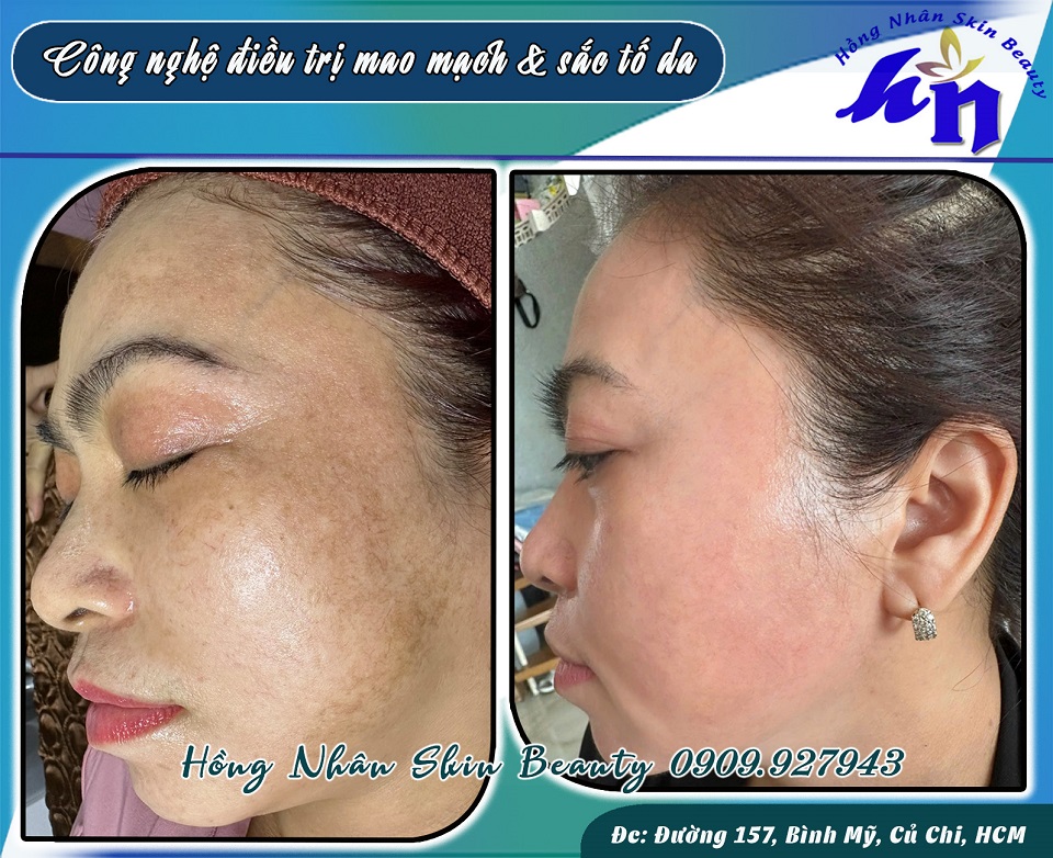 c phuong mm hns 1 copy
