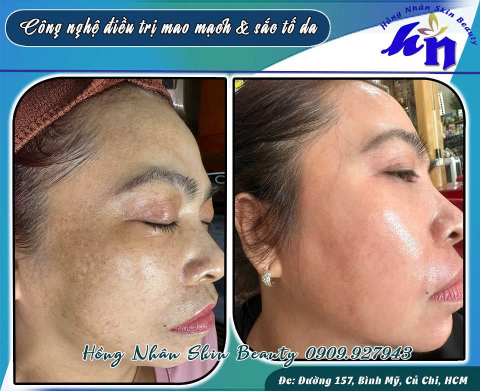 c phuong mm hns 2 cp