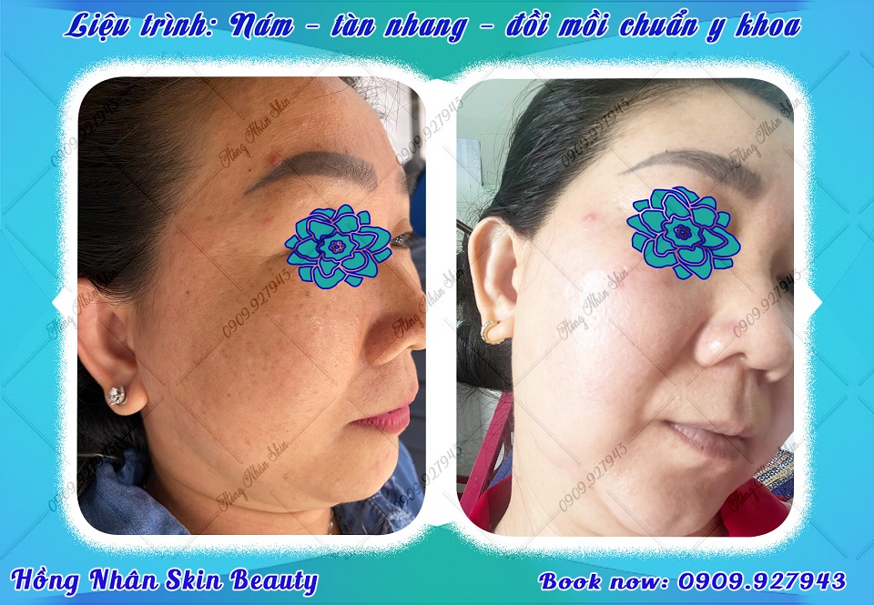 dang hns 040823 1 copy