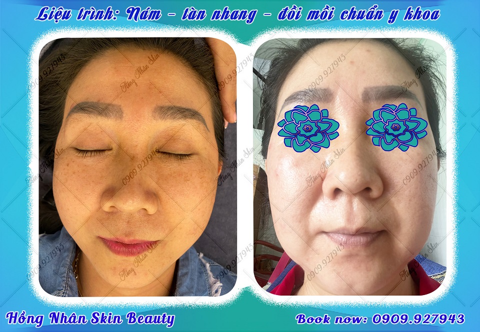 dang hns 040823 copy