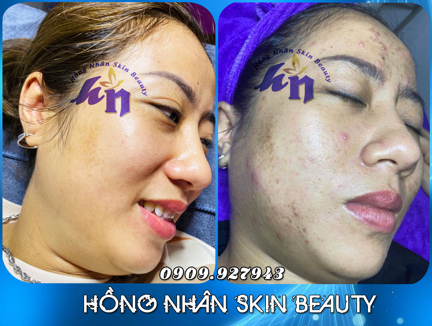 mun nam 3 3 22