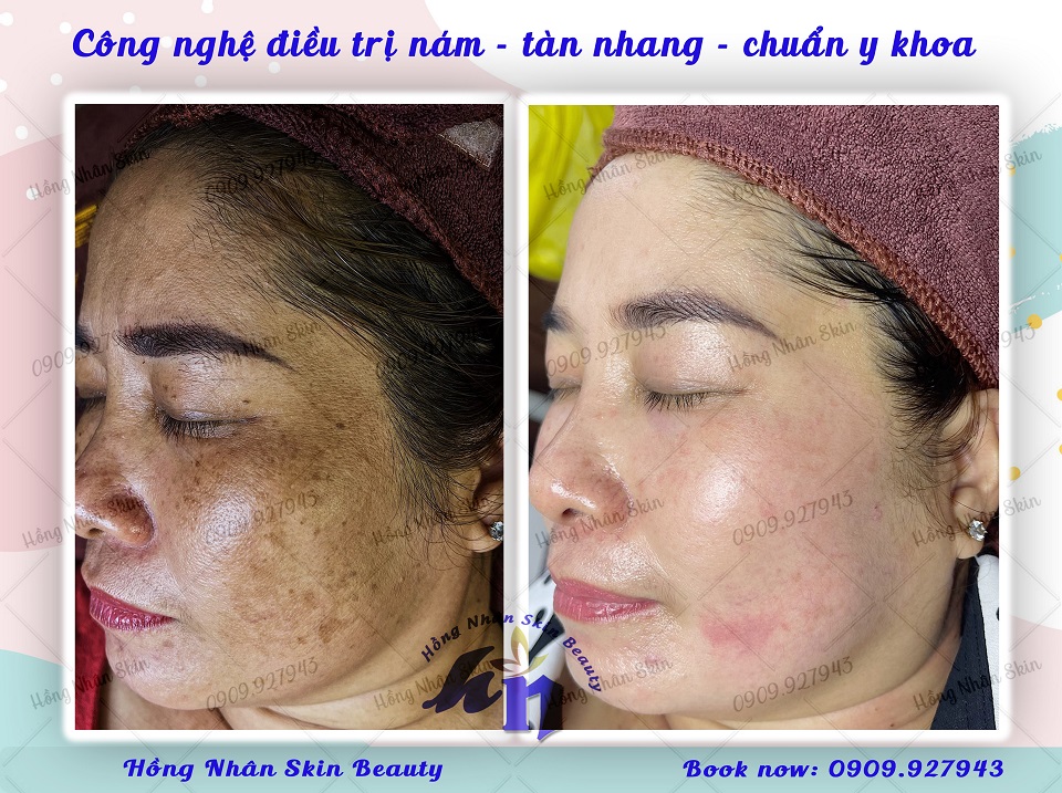 nam mang tan nhang 040423 phai w
