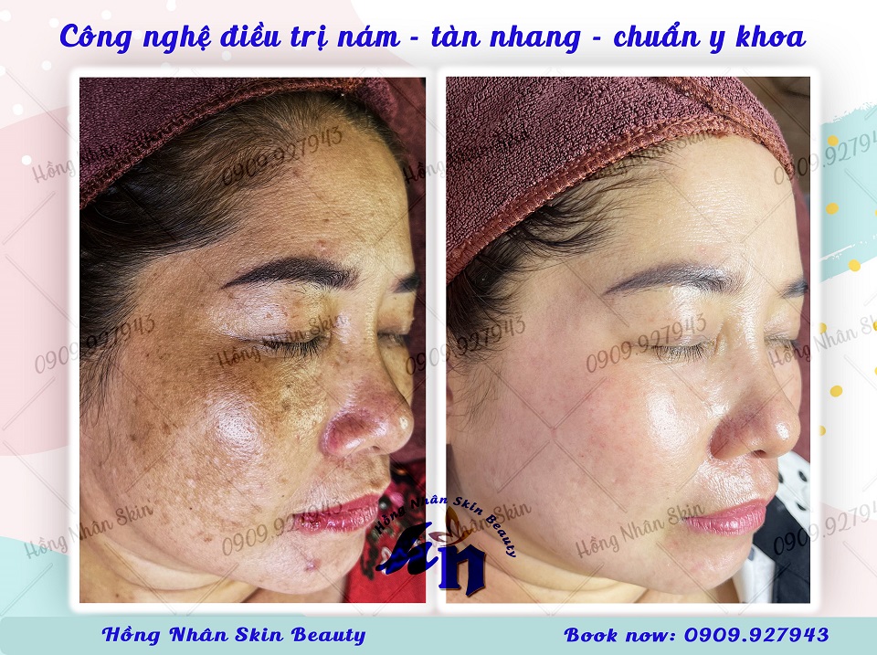 nam mang tan nhang 040423 w