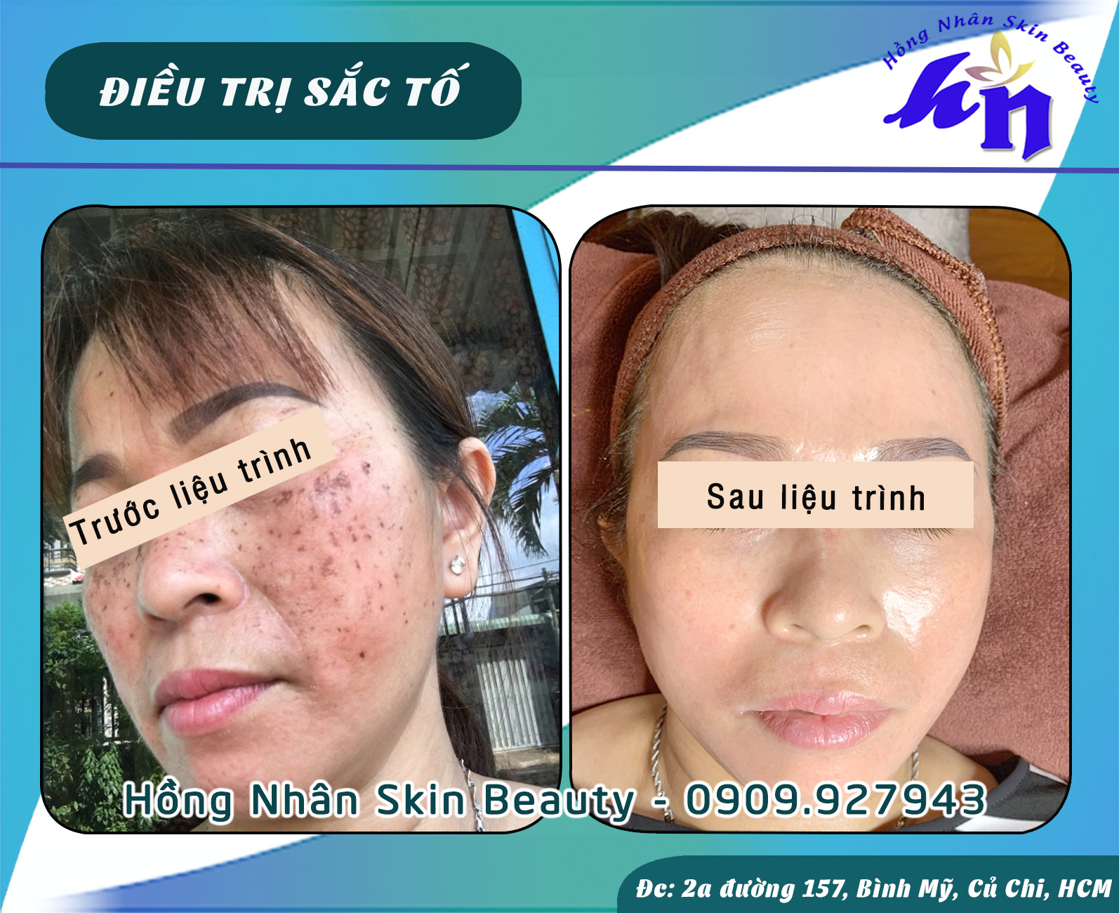 nam tan nhang 071123 hns