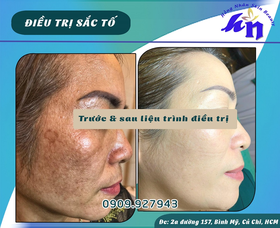 nam tan nhang 181123 hns copy