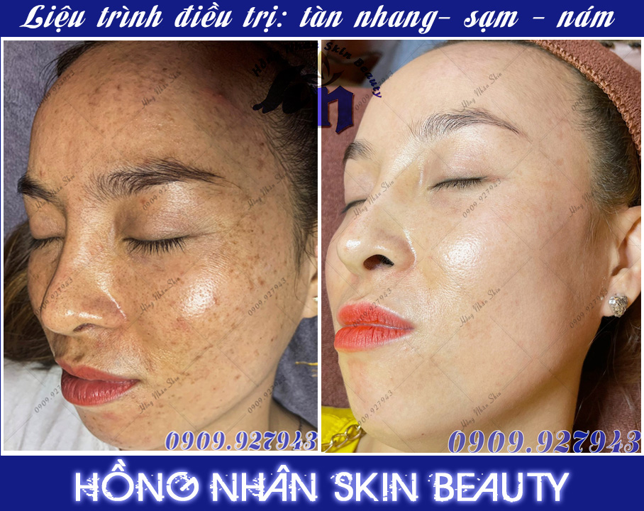 tan nhang group 01