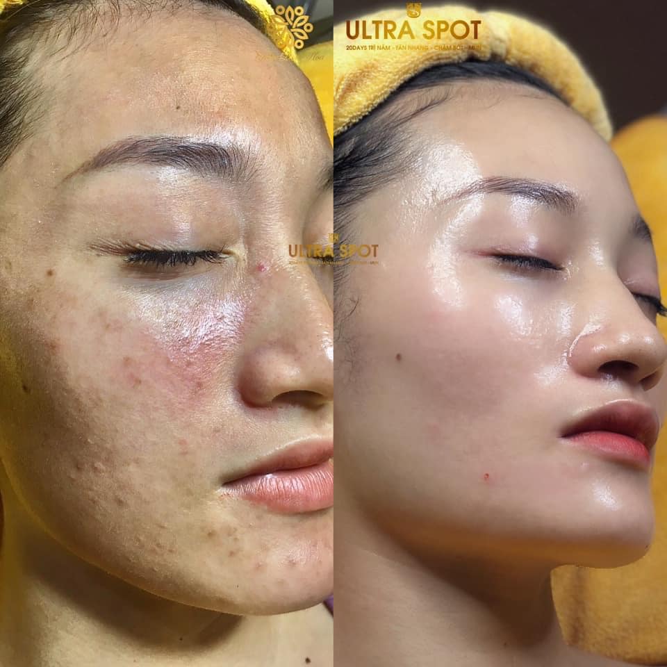 tan nhang 2