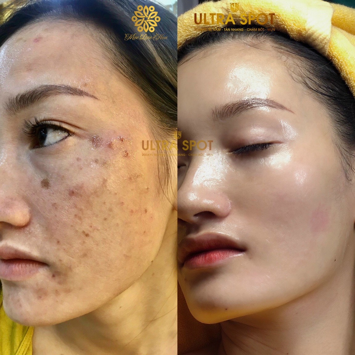 tan nhang 3