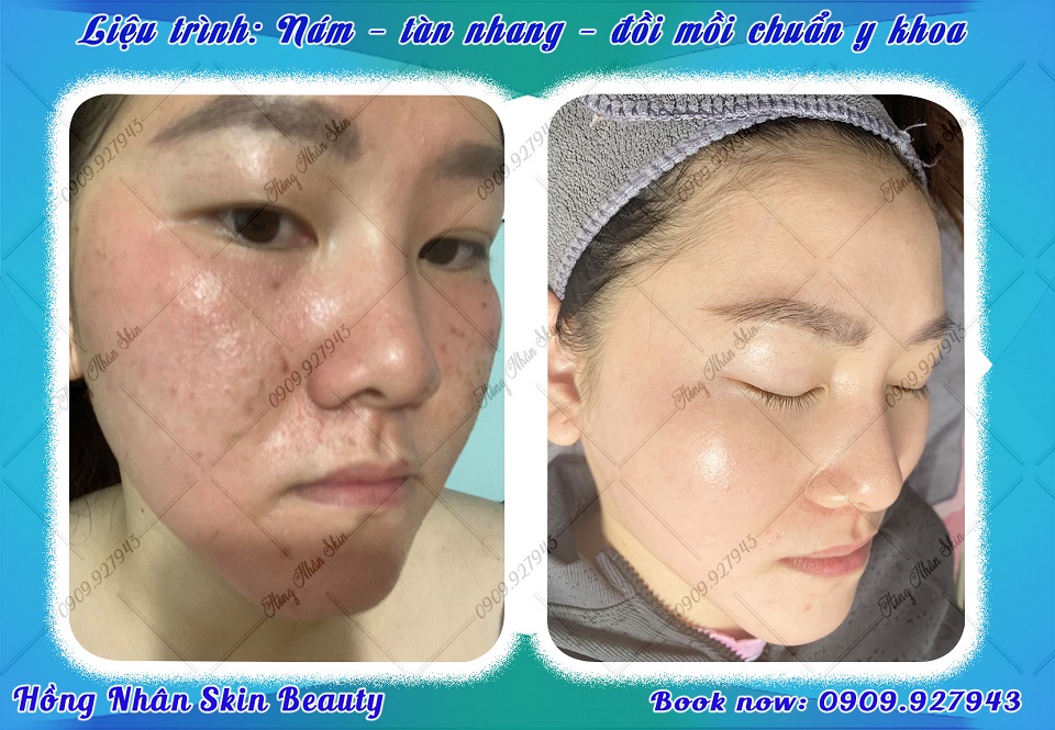dang hns 050723 copy