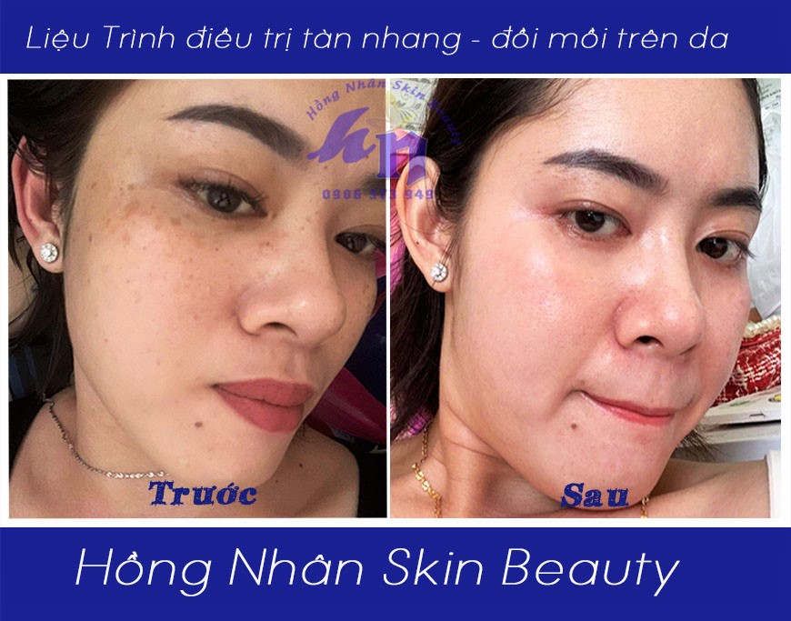 tan nhang k1