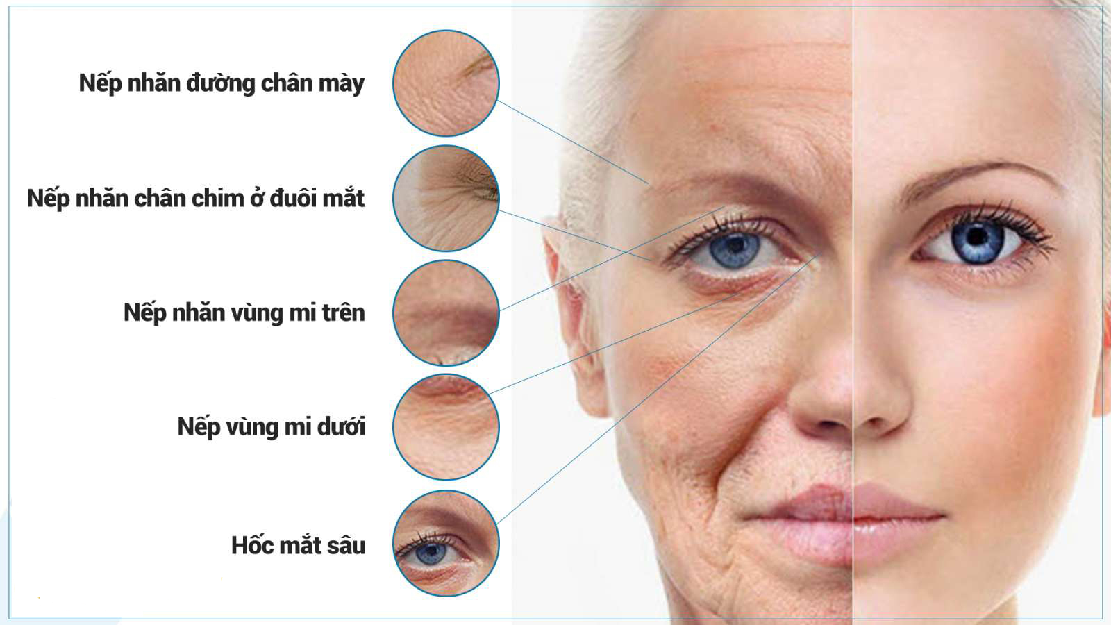 HỒNG NHÂN (XÓA NHĂN)