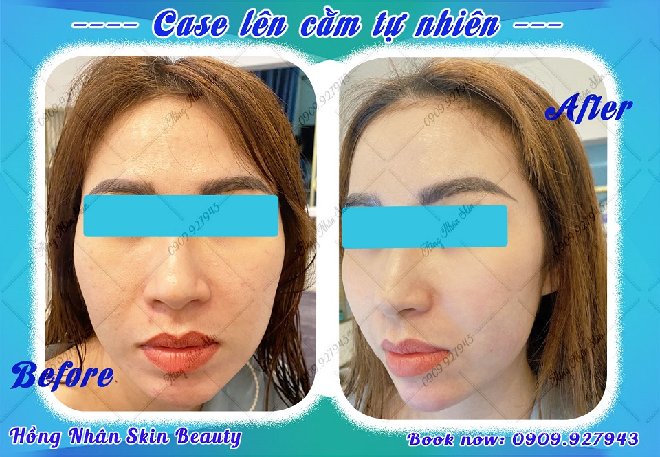 tiem cam copy
