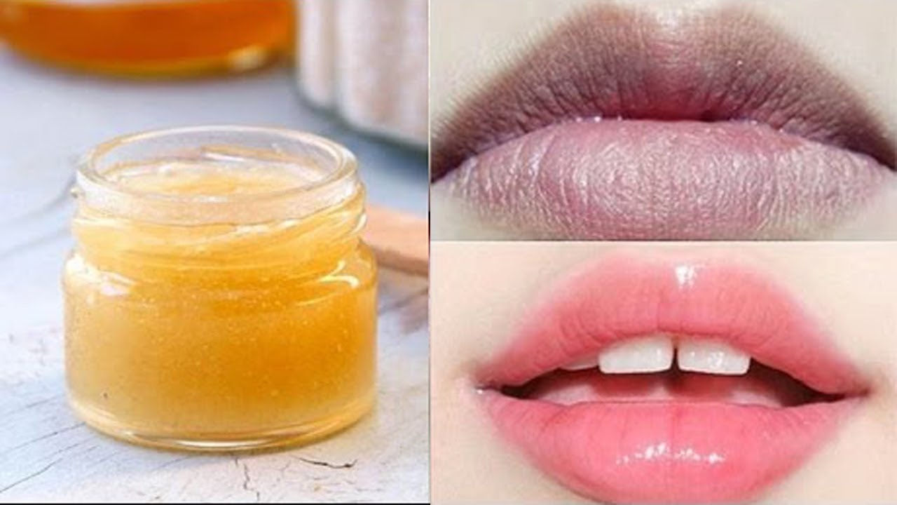 Công nghệ khử thâm môi nhẹ nhàng