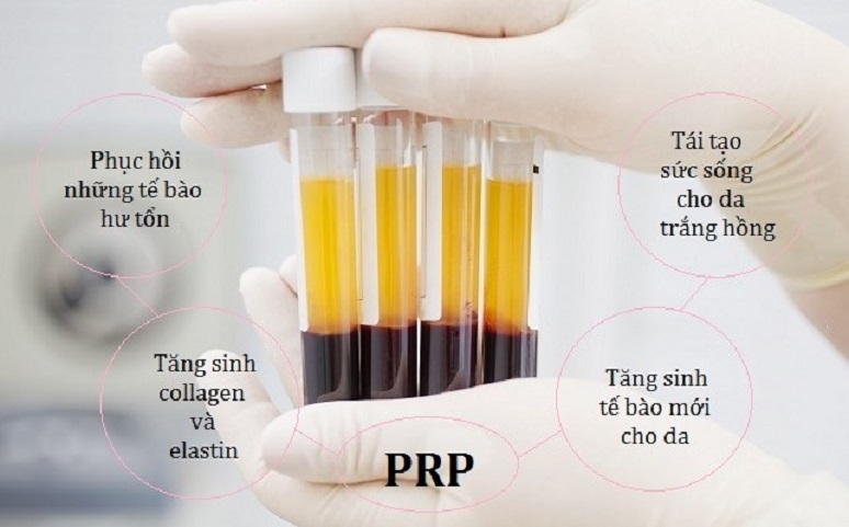 prp la gi