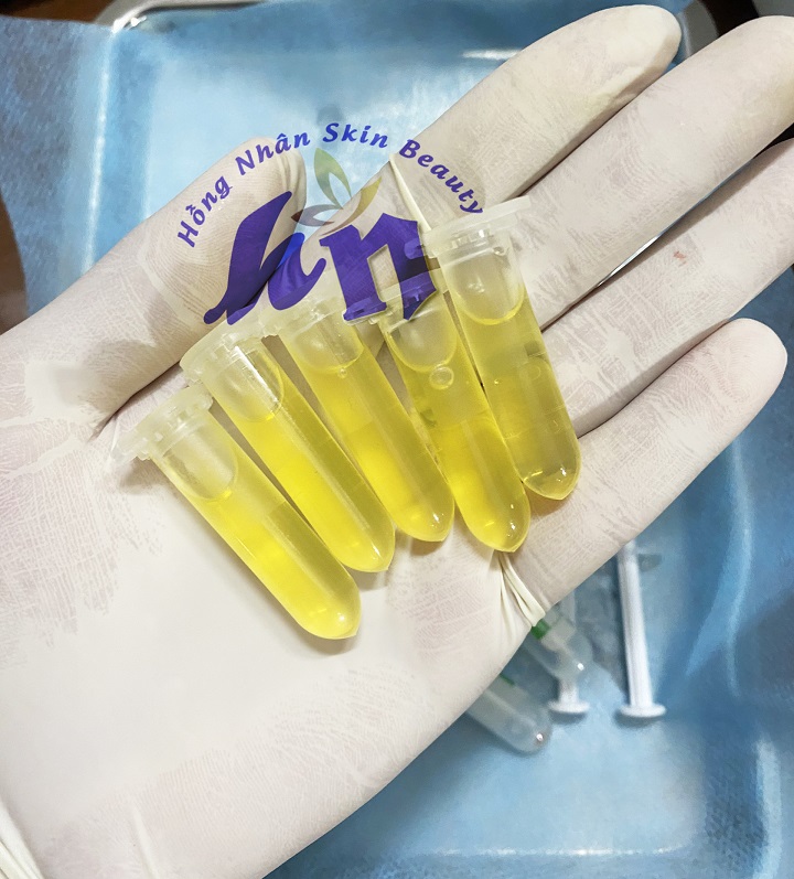 prp 1