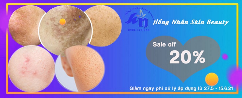 sale 1