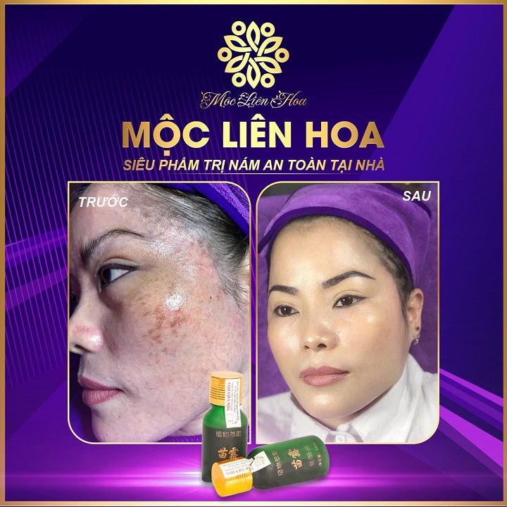moc lien hoa 6